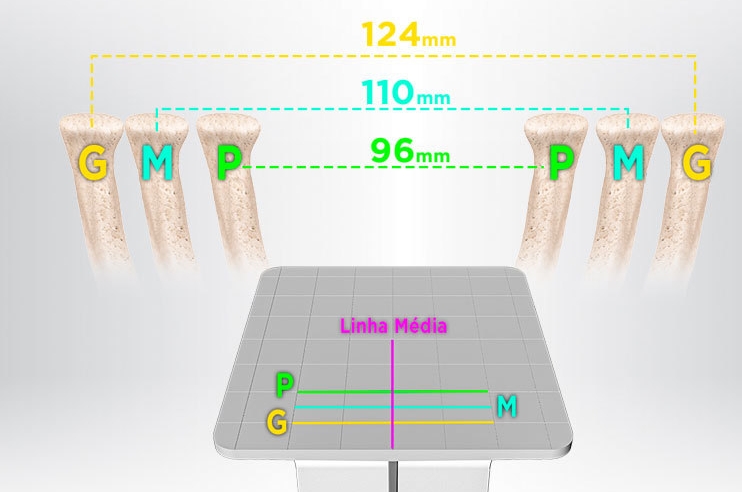 Halbverstellbarer Arcon-Artikulator Color | Präzise Simulation Zahnlabor