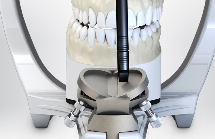 Halbverstellbarer Arcon-Artikulator Color | Präzise Simulation Zahnlabor